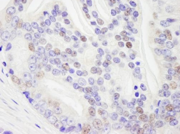Immunohistochemistry (Formalin/PFA-fixed paraffin-embedded sections) - Anti-RNA Helicase A antibody (AB245439)