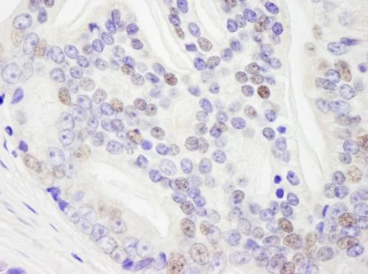 Immunohistochemistry (Formalin/PFA-fixed paraffin-embedded sections) - Anti-RNA Helicase A antibody (AB245439)