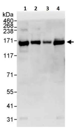 Western blot - Anti-RNA Helicase A antibody (AB245439)