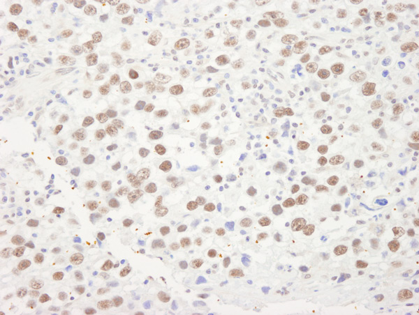 Immunohistochemistry (Formalin/PFA-fixed paraffin-embedded sections) - Anti-RNA Helicase A antibody (AB70777), expandable thumbnail
