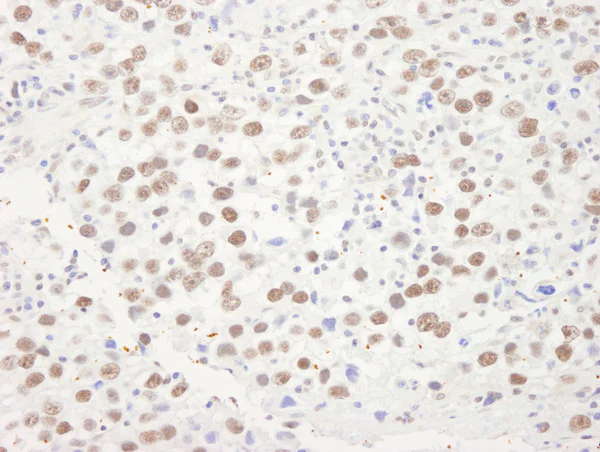 Immunohistochemistry (Formalin/PFA-fixed paraffin-embedded sections) - Anti-RNA Helicase A antibody (AB70777)