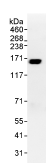 Immunoprecipitation - Anti-RNA Helicase A antibody (AB70777), expandable thumbnail