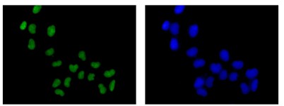 Immunocytochemistry/ Immunofluorescence - Anti-RNA Helicase A antibody [EPR13521] (AB183731)