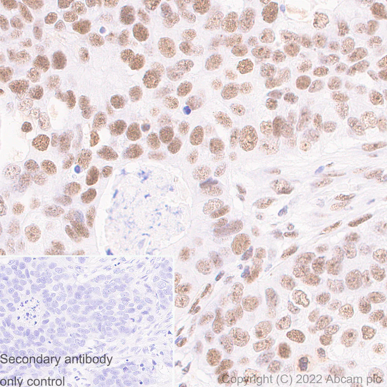 Immunohistochemistry (Formalin/PFA-fixed paraffin-embedded sections) - Anti-RNA Helicase A antibody [EPR13521] (AB183731)