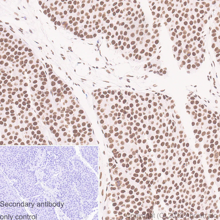 Immunohistochemistry (Formalin/PFA-fixed paraffin-embedded sections) - Anti-RNA Helicase A antibody [EPR13521] (AB183731)