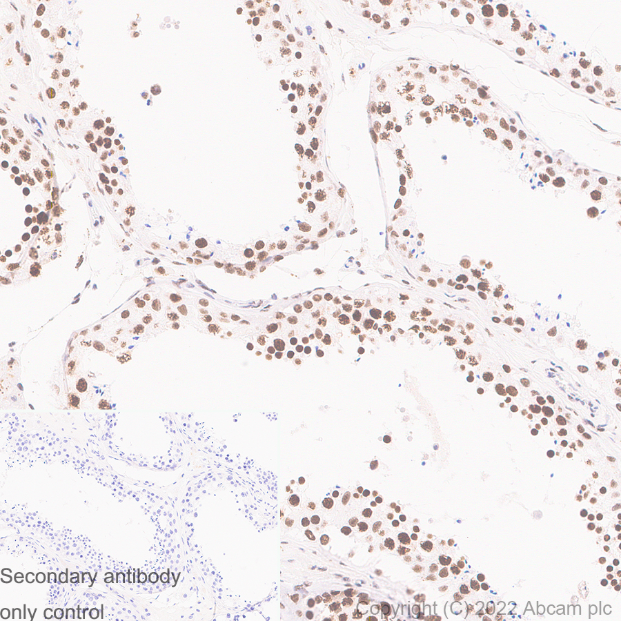Immunohistochemistry (Formalin/PFA-fixed paraffin-embedded sections) - Anti-RNA Helicase A antibody [EPR13521] (AB183731)