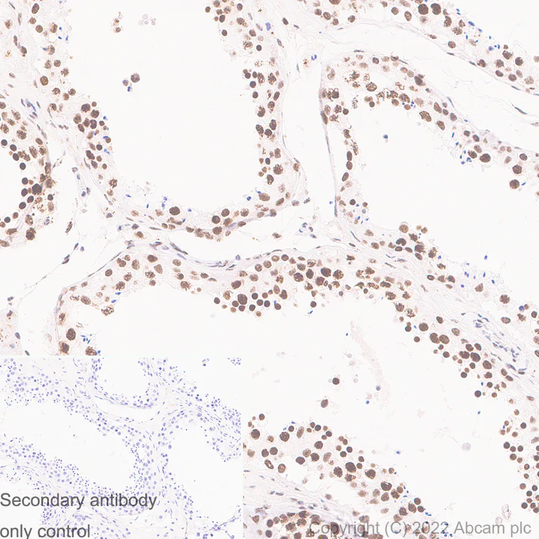 Immunohistochemistry (Formalin/PFA-fixed paraffin-embedded sections) - Anti-RNA Helicase A antibody [EPR13521] (AB183731)