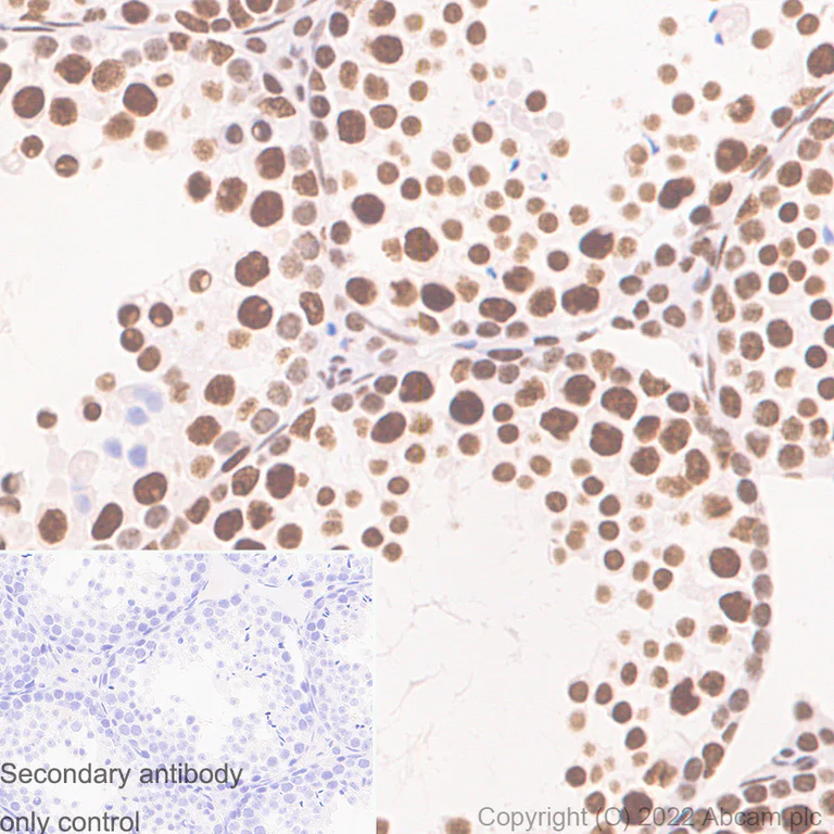 Immunohistochemistry (Formalin/PFA-fixed paraffin-embedded sections) - Anti-RNA Helicase A antibody [EPR13521] (AB183731)