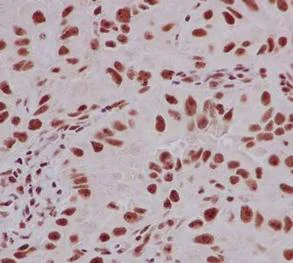 Immunohistochemistry (Formalin/PFA-fixed paraffin-embedded sections) - Anti-RNA Helicase A antibody [EPR13521] (AB183731)