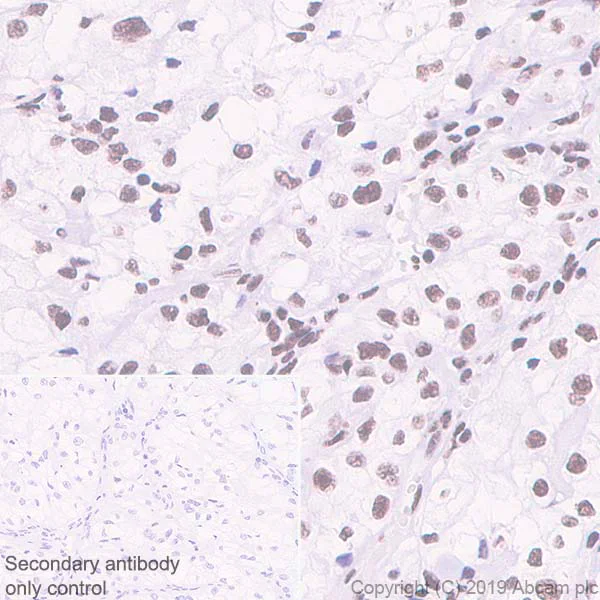 Immunohistochemistry (Formalin/PFA-fixed paraffin-embedded sections) - Anti-RNA Helicase A antibody [EPR13521] - BSA and Azide free (AB238985)