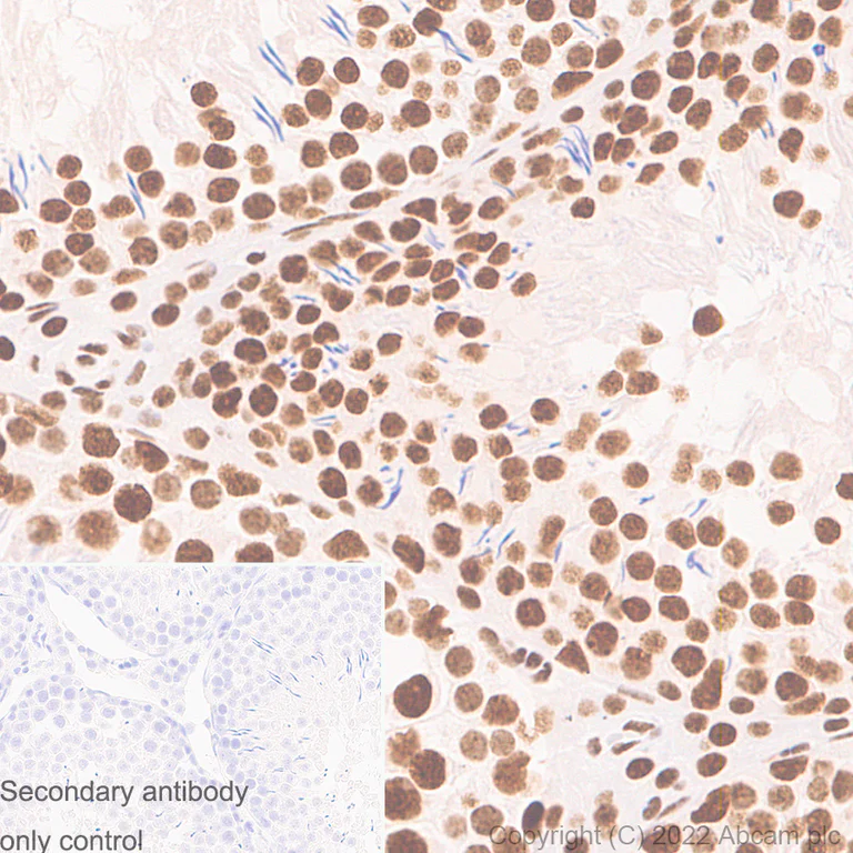 Immunohistochemistry (Formalin/PFA-fixed paraffin-embedded sections) - Anti-RNA Helicase A antibody [EPR13521] - BSA and Azide free (AB238985)