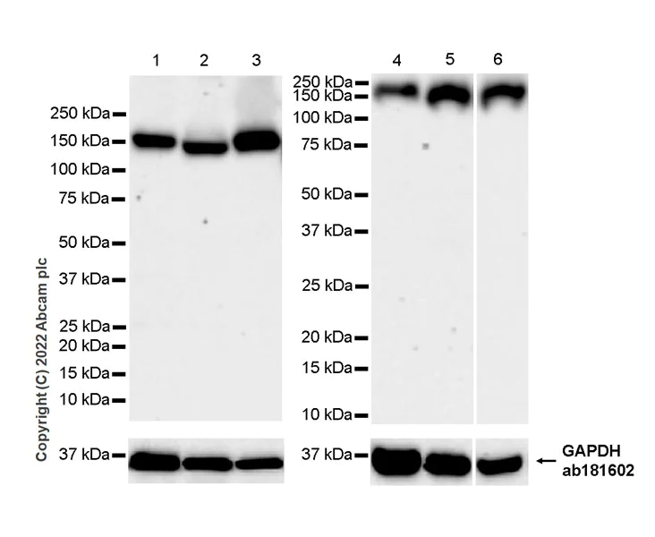 Western blot - Anti-RNA Helicase A antibody [EPR13521] - BSA and Azide free (AB238985)