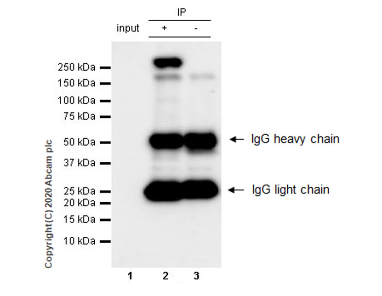 Immunoprecipitation - Anti-RNA polymerase II CTD repeat YSPTSPS antibody [1C7] (AB252854)