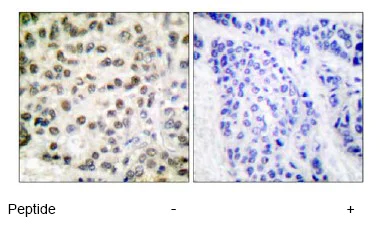 Immunohistochemistry (Formalin/PFA-fixed paraffin-embedded sections) - Anti-RNA polymerase II CTD repeat YSPTSPS antibody (AB52202)