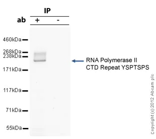 Immunoprecipitation - Anti-RNA polymerase II CTD repeat YSPTSPS antibody - ChIP Grade (AB26721)