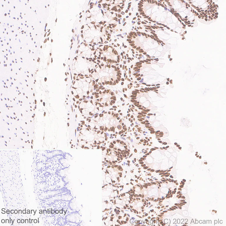 Immunohistochemistry (Formalin/PFA-fixed paraffin-embedded sections) - Anti-RNA polymerase II CTD repeat YSPTSPS antibody [EPR24494-59] - ChIP Grade - BSA and Azide free (AB300576)