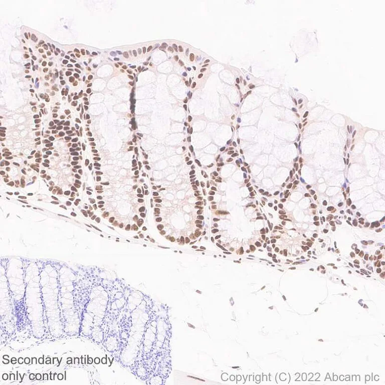 Immunohistochemistry (Formalin/PFA-fixed paraffin-embedded sections) - Anti-RNA polymerase II CTD repeat YSPTSPS antibody [EPR24494-59] - ChIP Grade - BSA and Azide free (AB300576)