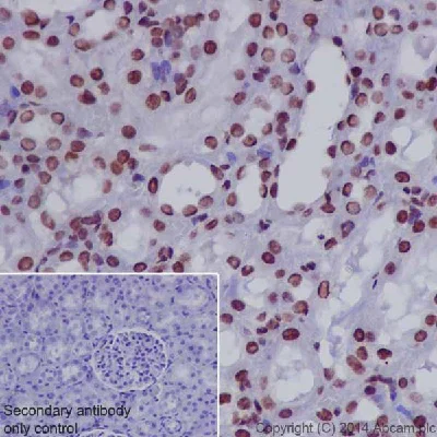 Immunohistochemistry (Formalin/PFA-fixed paraffin-embedded sections) - Anti-RNA polymerase II CTD repeat YSPTSPS (phospho S2) antibody (AB5095)