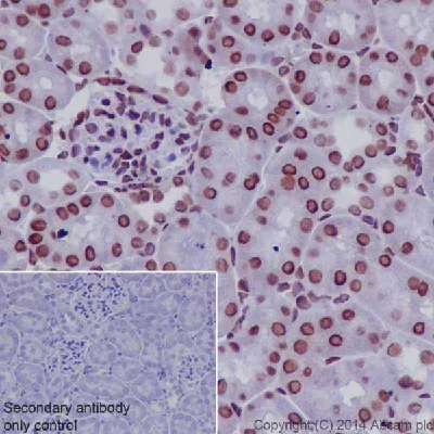 Immunohistochemistry (Formalin/PFA-fixed paraffin-embedded sections) - Anti-RNA polymerase II CTD repeat YSPTSPS (phospho S2) antibody (AB5095)
