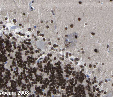 Immunohistochemistry (Formalin/PFA-fixed paraffin-embedded sections) - Anti-RNA polymerase II CTD repeat YSPTSPS (phospho S2) antibody (AB5095)