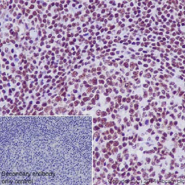 Immunohistochemistry (Formalin/PFA-fixed paraffin-embedded sections) - Anti-RNA polymerase II CTD repeat YSPTSPS (phospho S2) antibody (AB5095)