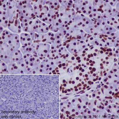 Immunohistochemistry (Formalin/PFA-fixed paraffin-embedded sections) - Anti-RNA polymerase II CTD repeat YSPTSPS (phospho S2) antibody (AB5095)