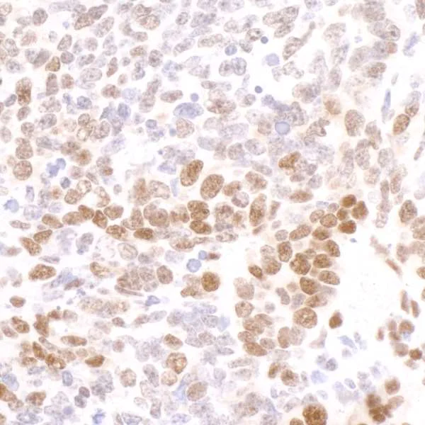 Immunohistochemistry (Formalin/PFA-fixed paraffin-embedded sections) - Anti-RNA polymerase II CTD repeat YSPTSPS (phospho S2) antibody (AB70324)