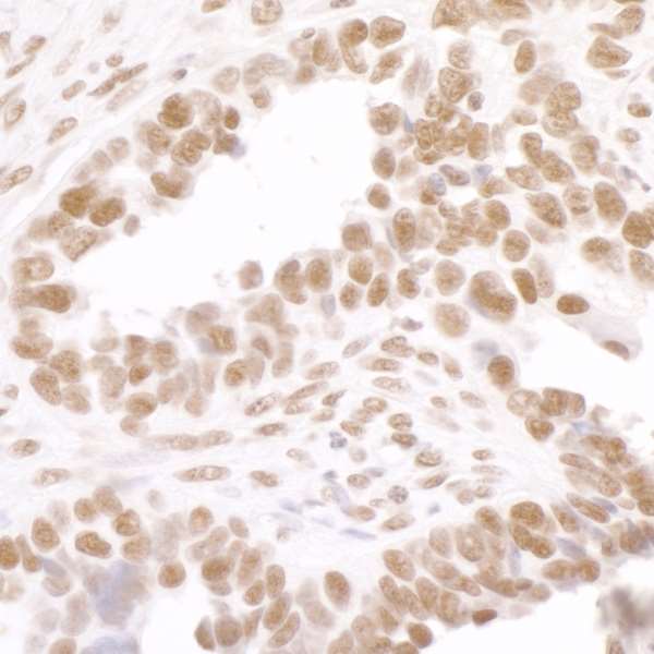 Immunohistochemistry (Formalin/PFA-fixed paraffin-embedded sections) - Anti-RNA polymerase II CTD repeat YSPTSPS (phospho S2) antibody (AB70324)