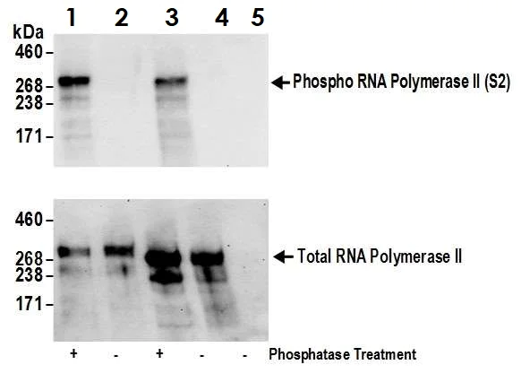 Immunoprecipitation - Anti-RNA polymerase II CTD repeat YSPTSPS (phospho S2) antibody (AB70324)