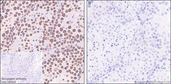 Immunohistochemistry (Formalin/PFA-fixed paraffin-embedded sections) - Anti-RNA polymerase II CTD repeat YSPTSPS (phospho S2) antibody [EPR18855-87] - ChIP Grade (AB238146)