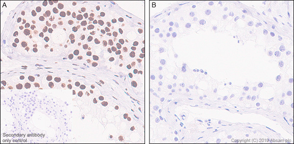 Immunohistochemistry (Formalin/PFA-fixed paraffin-embedded sections) - Anti-RNA polymerase II CTD repeat YSPTSPS (phospho S2) antibody [EPR18855-87] - ChIP Grade (ab238146), expandable thumbnail