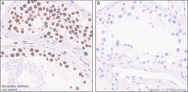 Immunohistochemistry (Formalin/PFA-fixed paraffin-embedded sections) - Anti-RNA polymerase II CTD repeat YSPTSPS (phospho S2) antibody [EPR18855-87] - ChIP Grade (AB238146)