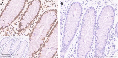 Immunohistochemistry (Formalin/PFA-fixed paraffin-embedded sections) - Anti-RNA polymerase II CTD repeat YSPTSPS (phospho S5) antibody [EP1510Y] (AB76292), expandable thumbnail