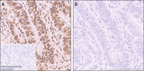 Immunohistochemistry (Formalin/PFA-fixed paraffin-embedded sections) - Anti-RNA polymerase II CTD repeat YSPTSPS (phospho S5) antibody [EP1510Y] (ab76292), expandable thumbnail