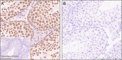 Immunohistochemistry (Formalin/PFA-fixed paraffin-embedded sections) - Anti-RNA polymerase II CTD repeat YSPTSPS (phospho S5) antibody [EP1510Y] (AB76292), expandable thumbnail