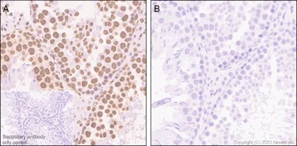 Immunohistochemistry (Formalin/PFA-fixed paraffin-embedded sections) - Anti-RNA polymerase II CTD repeat YSPTSPS (phospho S5) antibody [EP1510Y] (AB76292)