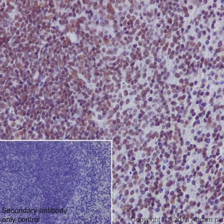 Immunohistochemistry (Formalin/PFA-fixed paraffin-embedded sections) - Anti-RNA polymerase II CTD repeat YSPTSPS (phospho S5) antibody [EPR19015] (AB193467)