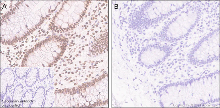 Immunohistochemistry (Formalin/PFA-fixed paraffin-embedded sections) - Anti-RNA polymerase II CTD repeat YSPTSPS (phospho S5) antibody [RM1152] (AB317456)