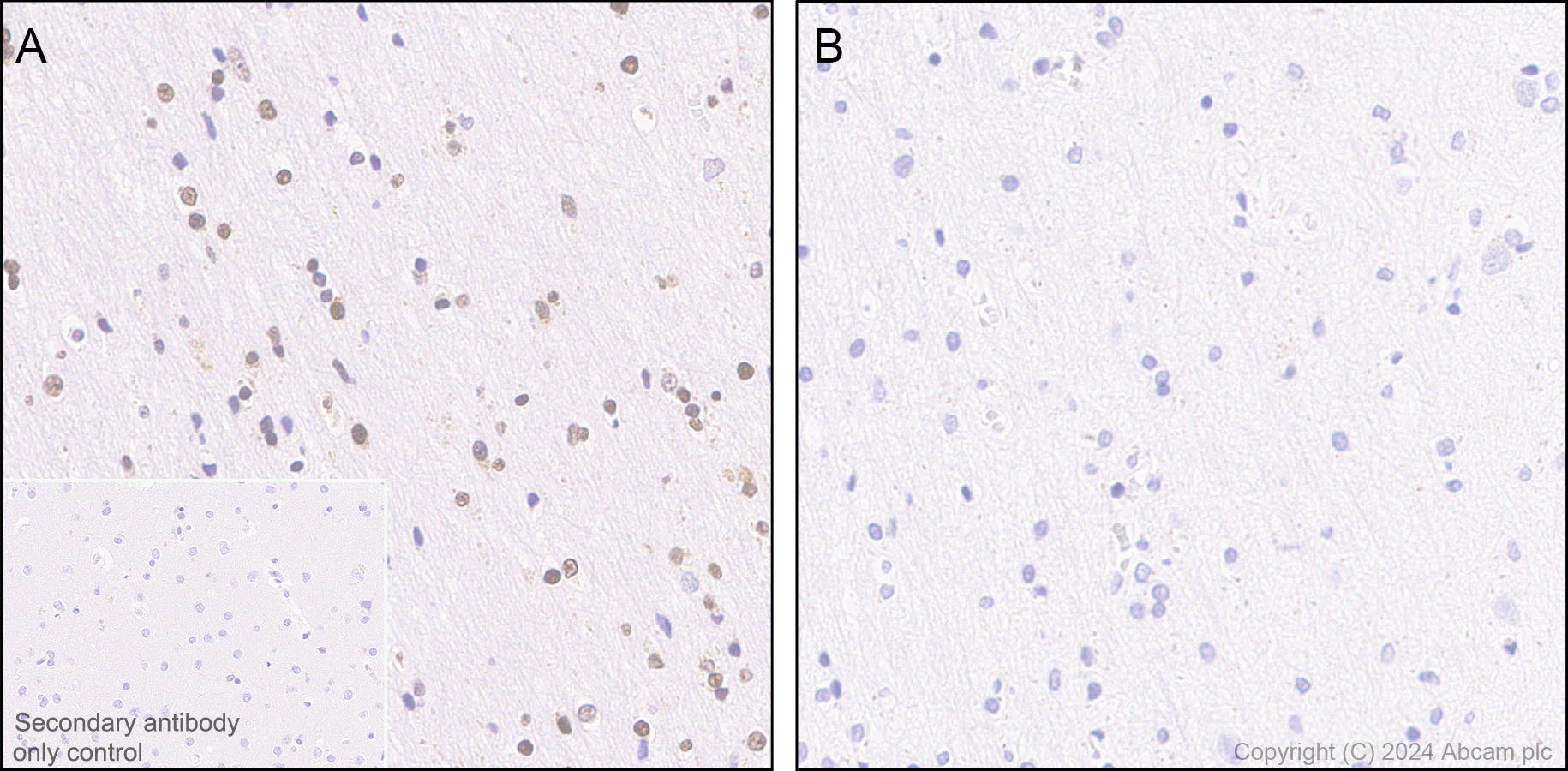Immunohistochemistry (Formalin/PFA-fixed paraffin-embedded sections) - Anti-RNA polymerase II CTD repeat YSPTSPS (phospho S5) antibody [RM1152] (ab317456), expandable thumbnail