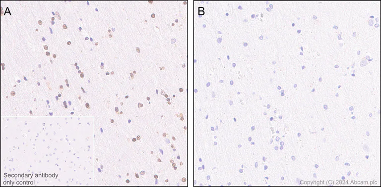 Immunohistochemistry (Formalin/PFA-fixed paraffin-embedded sections) - Anti-RNA polymerase II CTD repeat YSPTSPS (phospho S5) antibody [RM1152] (AB317456)