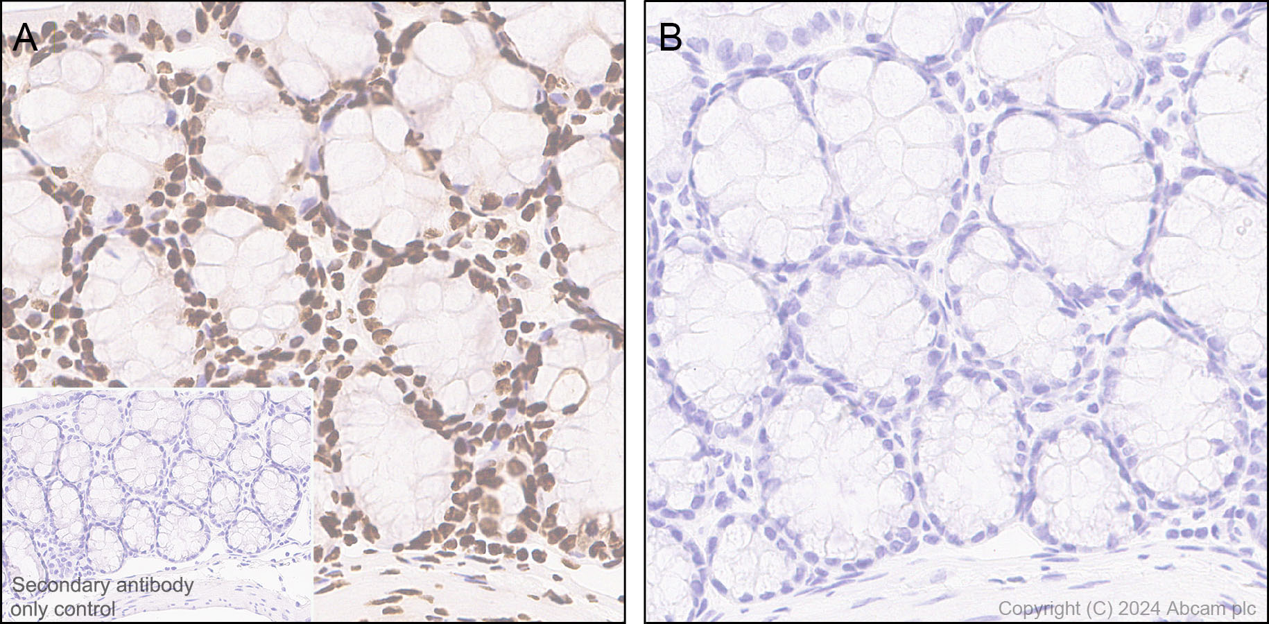 Immunohistochemistry (Formalin/PFA-fixed paraffin-embedded sections) - Anti-RNA polymerase II CTD repeat YSPTSPS (phospho S5) antibody [RM1152] (ab317456), expandable thumbnail