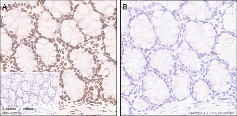 Immunohistochemistry (Formalin/PFA-fixed paraffin-embedded sections) - Anti-RNA polymerase II CTD repeat YSPTSPS (phospho S5) antibody [RM1152] (AB317456)