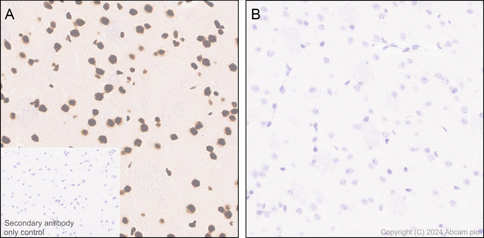 Immunohistochemistry (Formalin/PFA-fixed paraffin-embedded sections) - Anti-RNA polymerase II CTD repeat YSPTSPS (phospho S5) antibody [RM1152] (ab317456), expandable thumbnail
