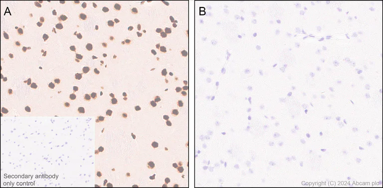 Immunohistochemistry (Formalin/PFA-fixed paraffin-embedded sections) - Anti-RNA polymerase II CTD repeat YSPTSPS (phospho S5) antibody [RM1152] (AB317456)