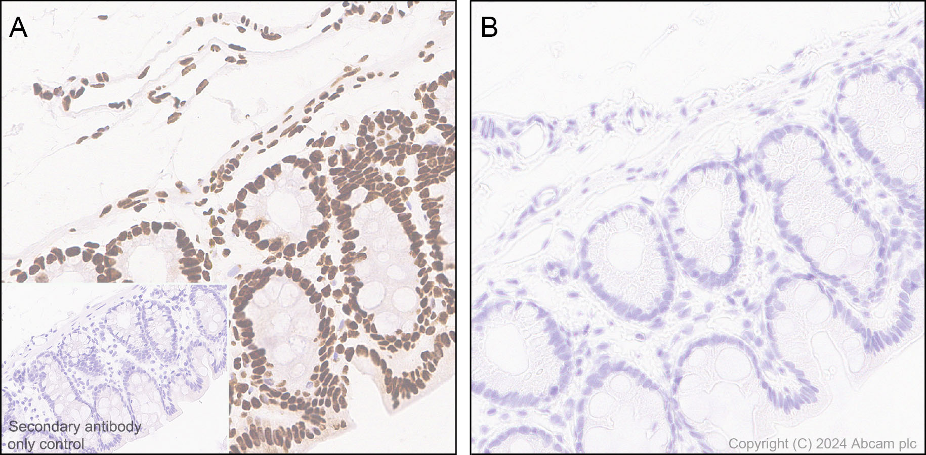 Immunohistochemistry (Formalin/PFA-fixed paraffin-embedded sections) - Anti-RNA polymerase II CTD repeat YSPTSPS (phospho S5) antibody [RM1152] (ab317456), expandable thumbnail