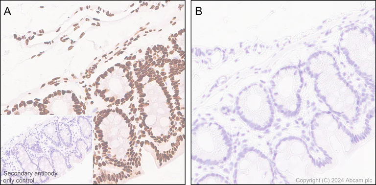 Immunohistochemistry (Formalin/PFA-fixed paraffin-embedded sections) - Anti-RNA polymerase II CTD repeat YSPTSPS (phospho S5) antibody [RM1152] (AB317456)