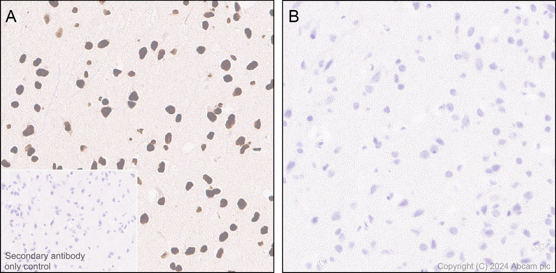 Immunohistochemistry (Formalin/PFA-fixed paraffin-embedded sections) - Anti-RNA polymerase II CTD repeat YSPTSPS (phospho S5) antibody [RM1152] (ab317456), expandable thumbnail
