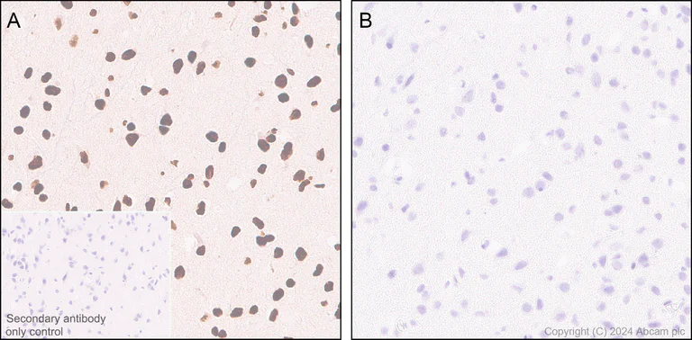 Immunohistochemistry (Formalin/PFA-fixed paraffin-embedded sections) - Anti-RNA polymerase II CTD repeat YSPTSPS (phospho S5) antibody [RM1152] (AB317456)