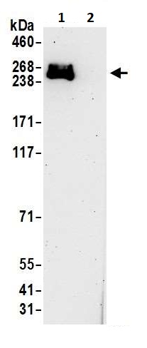 Immunoprecipitation - Anti-RNA polymerase II RPB1 antibody (AB264350)