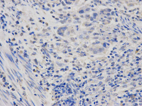 Immunohistochemistry (Formalin/PFA-fixed paraffin-embedded sections) - Anti-RNA polymerase II RPB4 antibody (AB186868)